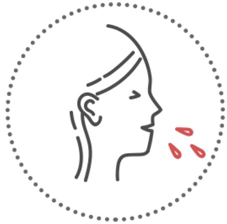 Рвота