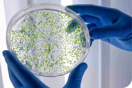 Las bacterias no tienen por qué ser perjudiciales. Los prebióticos ayudan a mantenerlas sanas